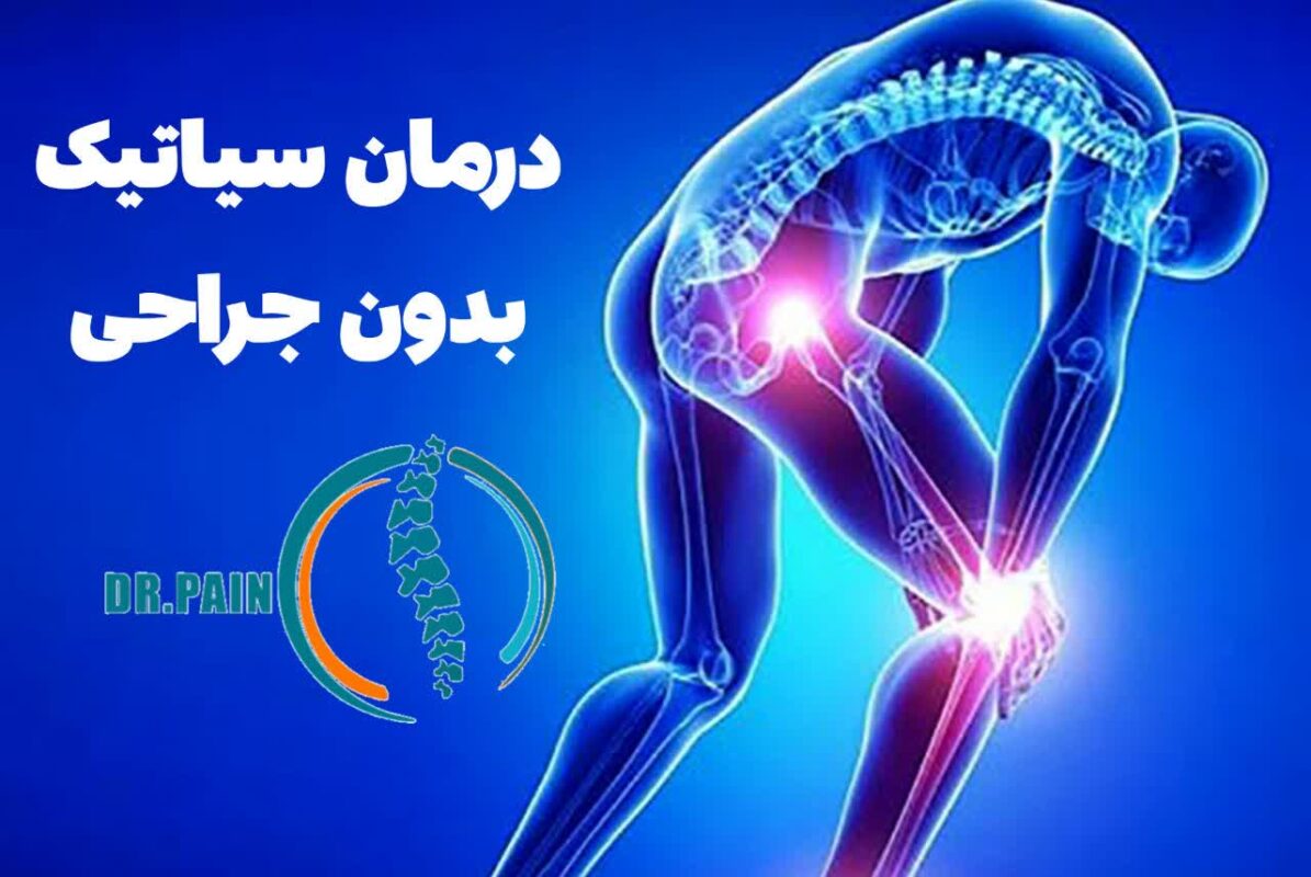 درمان سیاتیک برای همیشه بدون نیاز به جراحی