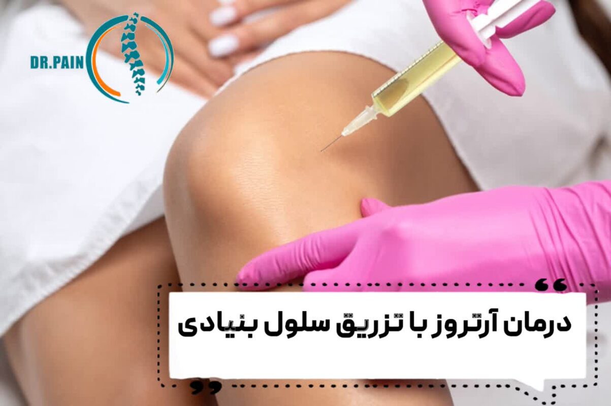 درمان آرتروز با سلول های بنیادی