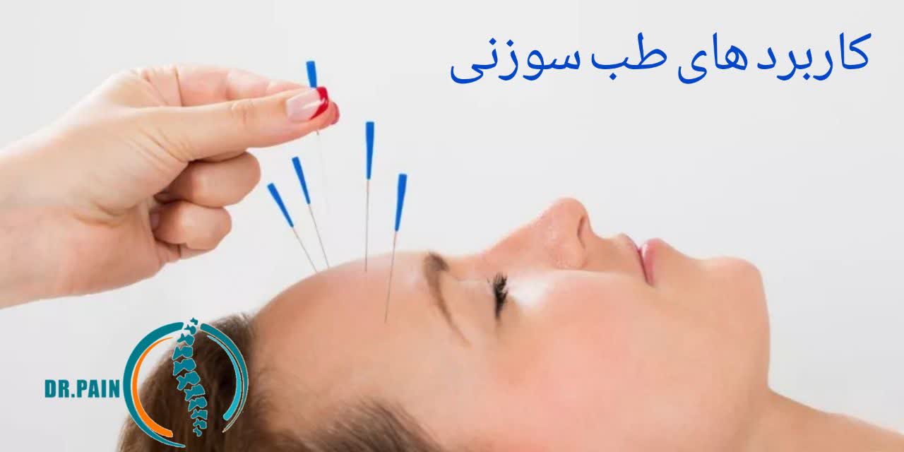 طب سوزنی چه بیماری‌ هایی را درمان می‌کند؟