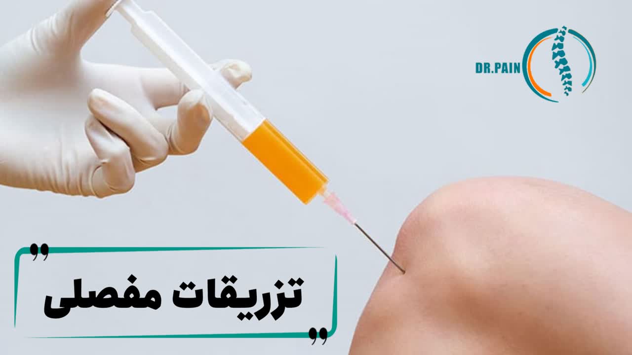 تزریقات مفصلی؛ راهکاری موثر برای تسکین درد مفاصل