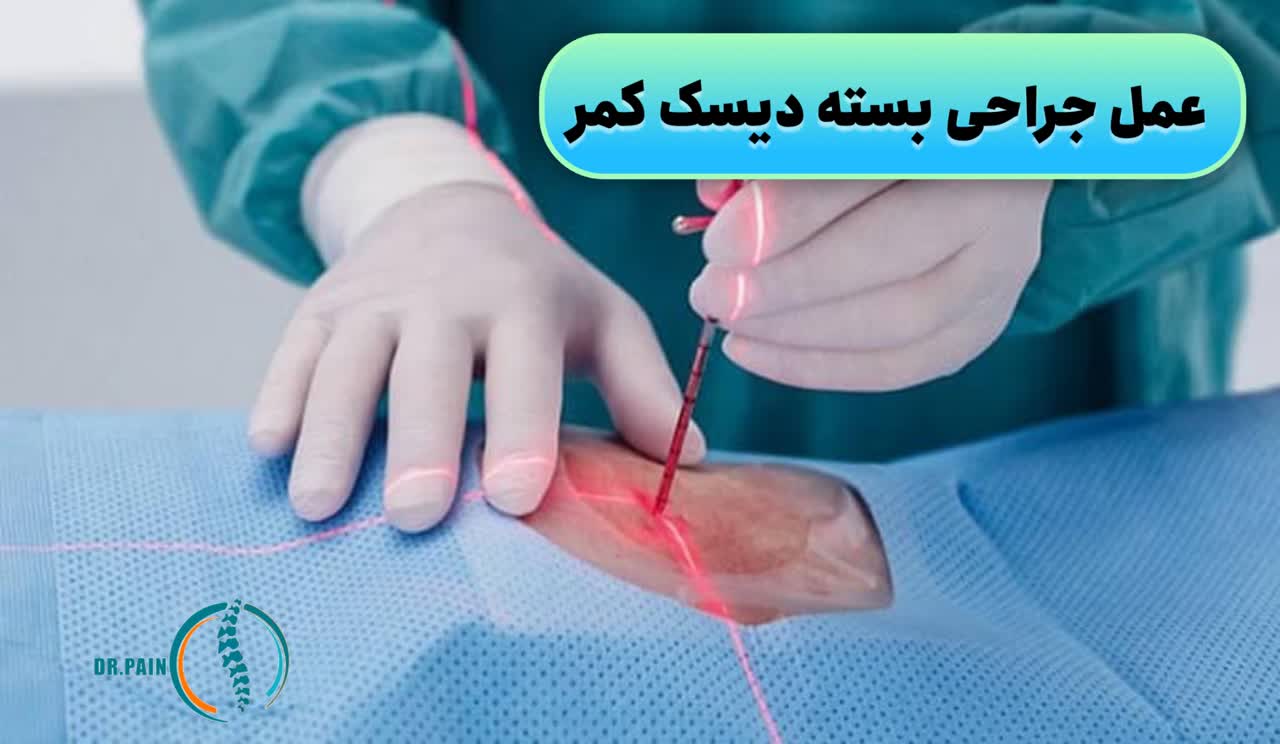 عمل جراحی بسته دیسک کمر