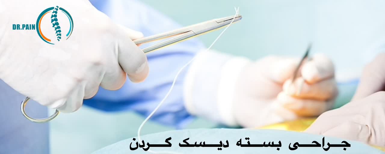 جراحی بسته دیسک گردن