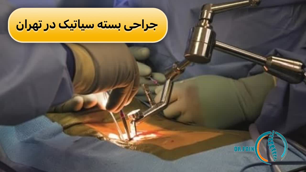 جراحی بسته سیاتیک در تهران