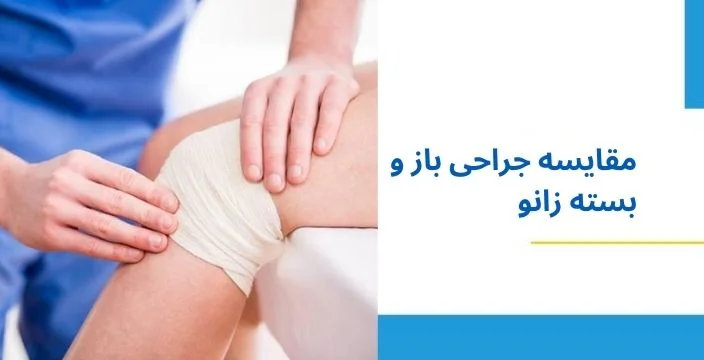 مقایسه ی جراحی های باز و بسته ی زانو