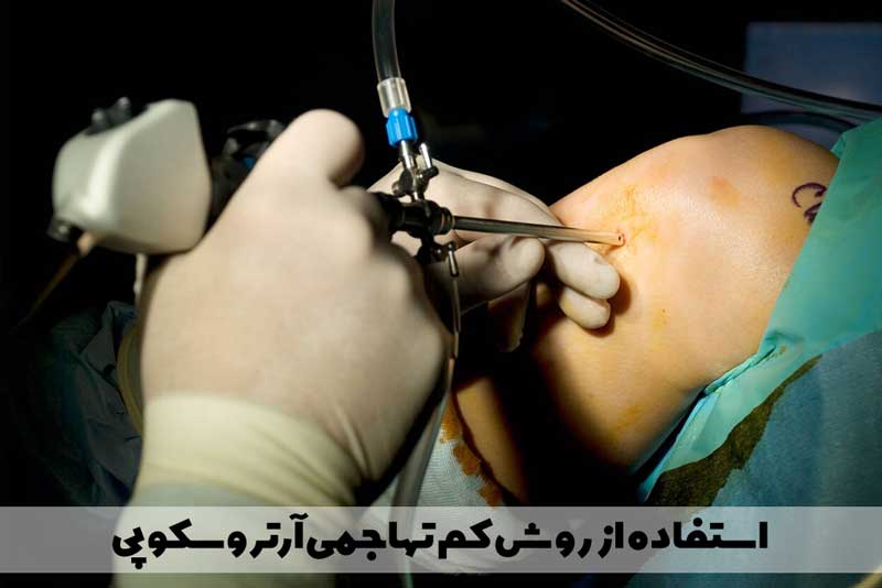 استفاده از روش کم تهاجمی آرتروسکوپی