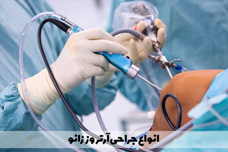 انواع روش های جراحی آرتروز زانو