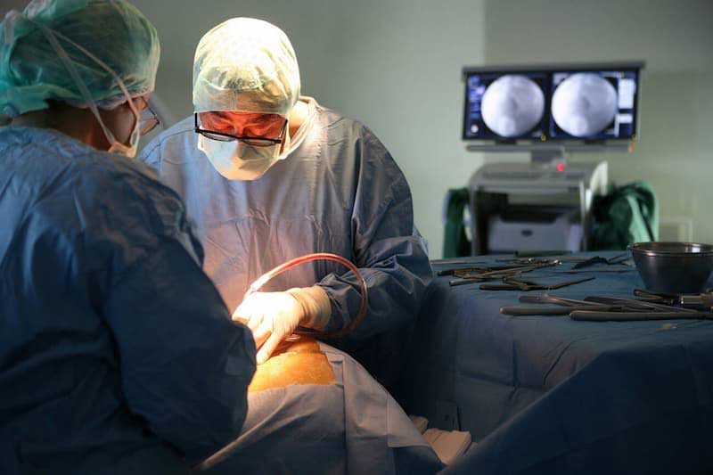 جراحی باز دیسک کمر