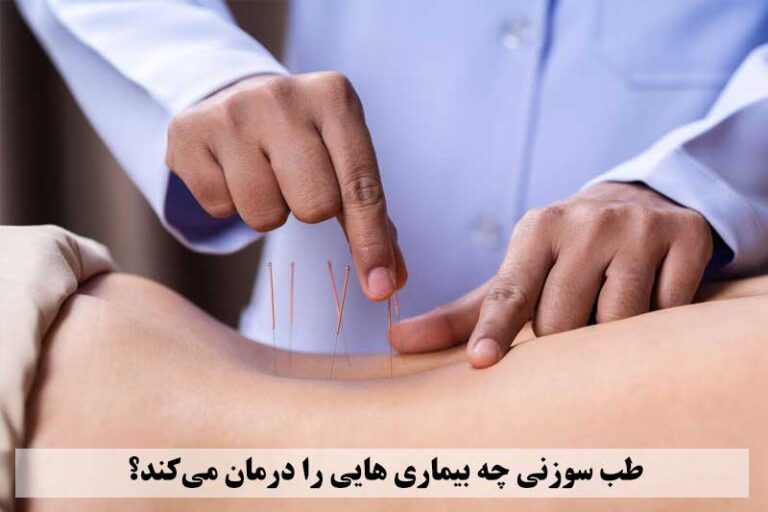 طب سوزنی چه بیماری‌ هایی را درمان می‌کند؟