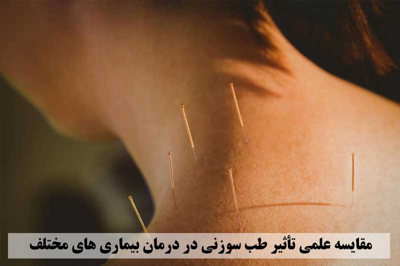 مقایسه علمی تأثیر طب سوزنی در درمان بیماری‌ های مختلف